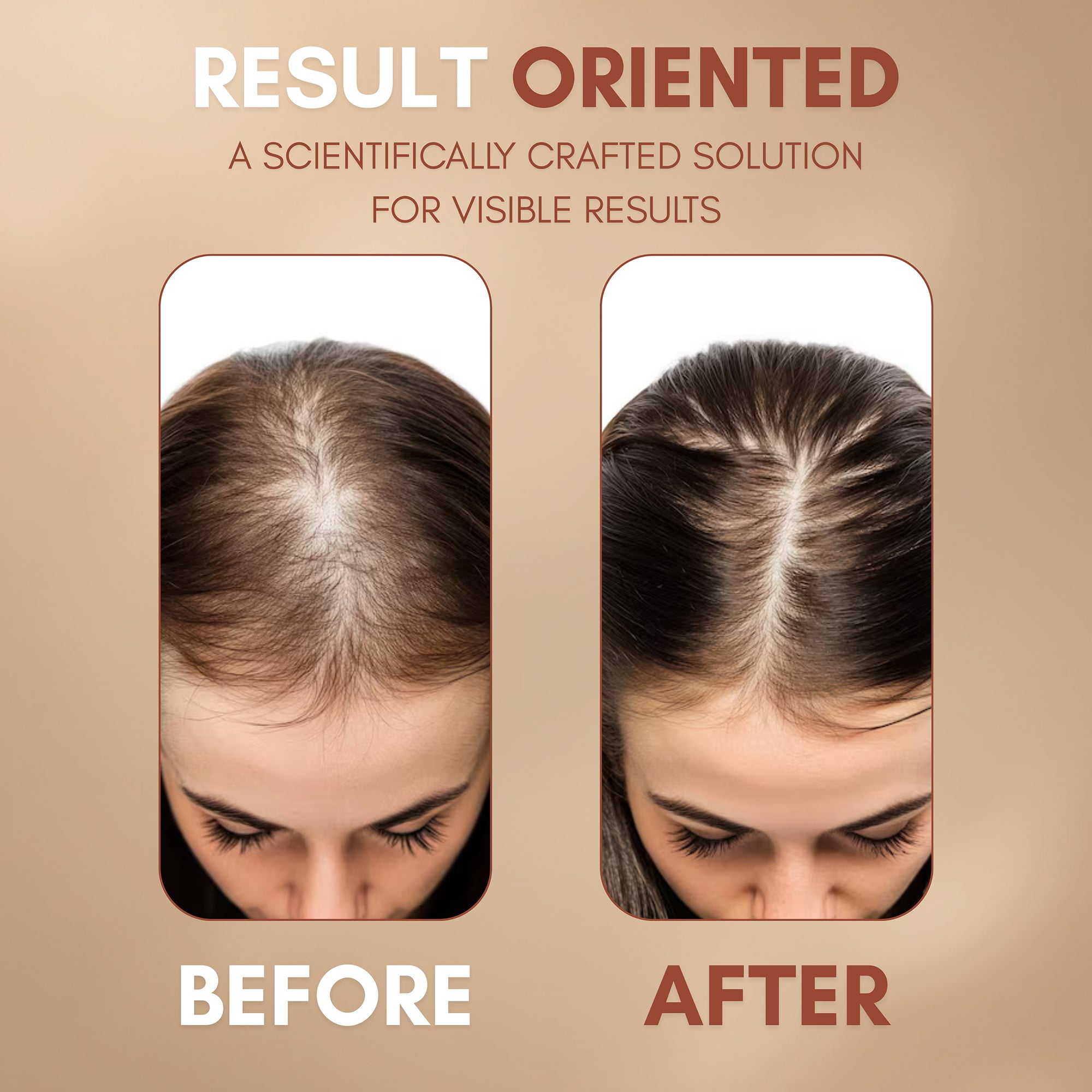 Buy 1 Get 2 Hair Don Capsules FREE – Limited Time Offer Banner 3